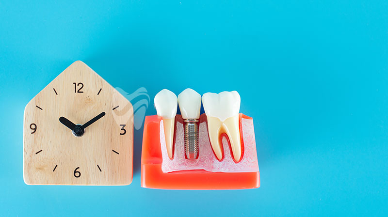 Bir Günde Sabit Dişli İmplant Tedavisi